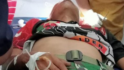 2 Anggota TNI Dibacok Pencuri Hingga Mengalami Luka Bacok
